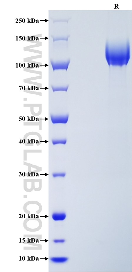 Purity of Recombinant Human EMR1 was determined by SDS-PAGE. The protein was resolved in an SDS-PAGE in reducing (R) conditions and stained using Coomassie blue.