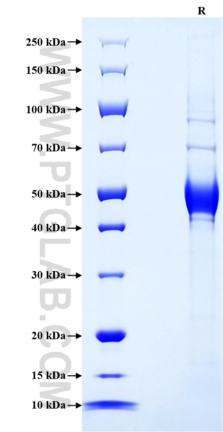 Purity of Recombinant Human CD160 was determined by SDS-PAGE. The protein was resolved in an SDS-PAGE in reducing (R) conditions and stained using Coomassie blue. Purity of Recombinant Human CD160 was determined by SDS-PAGE. The protein was resolved in an SDS-PAGE in reducing (R) conditions and stained using Coomassie blue.
