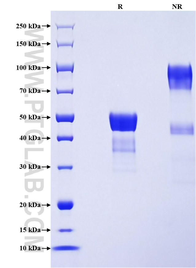 Purity of Recombinant Human CD99 was determined by SDS-PAGE. The protein was resolved in an SDS-PAGE in reducing (R) and non-reducing (NR) conditions and stained using Coomassie blue. Purity of Recombinant Human CD99 was determined by SDS-PAGE. The protein was resolved in an SDS-PAGE in reducing (R) and non-reducing (NR) conditions and stained using Coomassie blue.