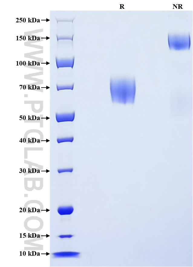 Purity of Recombinant Human CD89 was determined by SDS-PAGE. The protein was resolved in an SDS-PAGE in reducing (R) and non-reducing (NR) conditions and stained using Coomassie blue. Purity of Recombinant Human CD89 was determined by SDS-PAGE. The protein was resolved in an SDS-PAGE in reducing (R) and non-reducing (NR) conditions and stained using Coomassie blue.