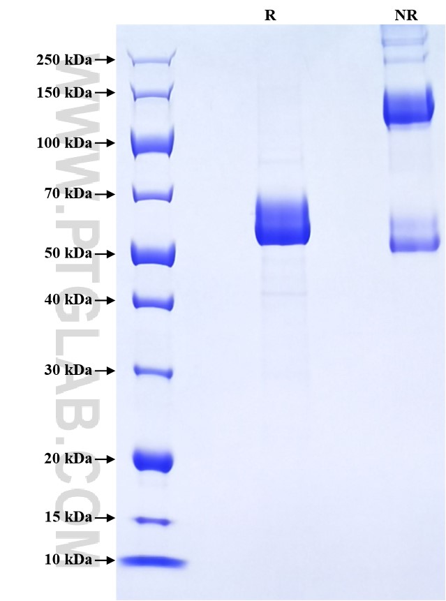 Purity of Recombinant Human CD84 was determined by SDS-PAGE. The protein was resolved in an SDS-PAGE in reducing (R) and non-reducing (NR) conditions and stained using Coomassie blue. Purity of Recombinant Human CD84 was determined by SDS-PAGE. The protein was resolved in an SDS-PAGE in reducing (R) and non-reducing (NR) conditions and stained using Coomassie blue.