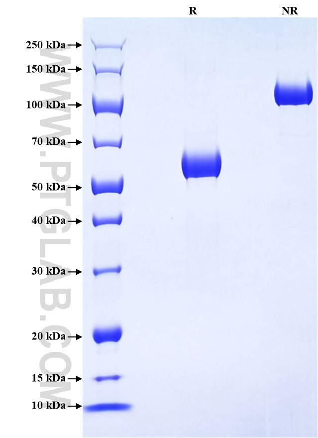 Purity of Recombinant Human CD72 was determined by SDS-PAGE. The protein was resolved in an SDS-PAGE in reducing (R) and non-reducing (NR) conditions and stained using Coomassie blue.