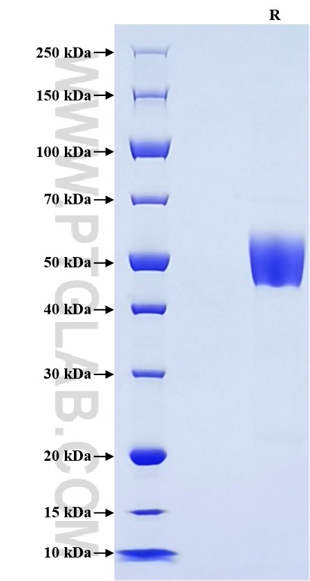 Purity of Recombinant Human CD37 was determined by SDS-PAGE. The protein was resolved in an SDS-PAGE in reducing (R) conditions and stained using Coomassie blue.