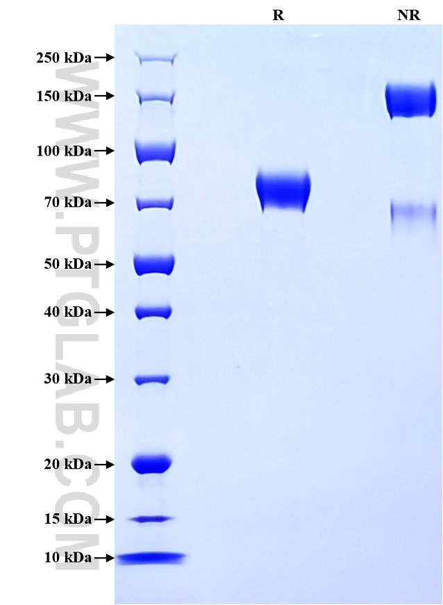 Purity of Recombinant Human CD46 was determined by SDS-PAGE. The protein was resolved in an SDS-PAGE in reducing (R) and non-reducing (NR) conditions and stained using Coomassie blue.