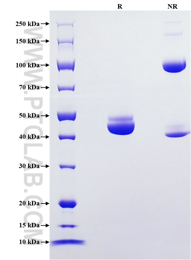 Purity of Recombinant Mouse TNF-alpha was determined by SDS-PAGE. The protein was resolved in an SDS-PAGE in reducing (R) and non-reducing (NR) conditions and stained using Coomassie blue. Purity of Recombinant Mouse TNF-alpha was determined by SDS-PAGE. The protein was resolved in an SDS-PAGE in reducing (R) and non-reducing (NR) conditions and stained using Coomassie blue.