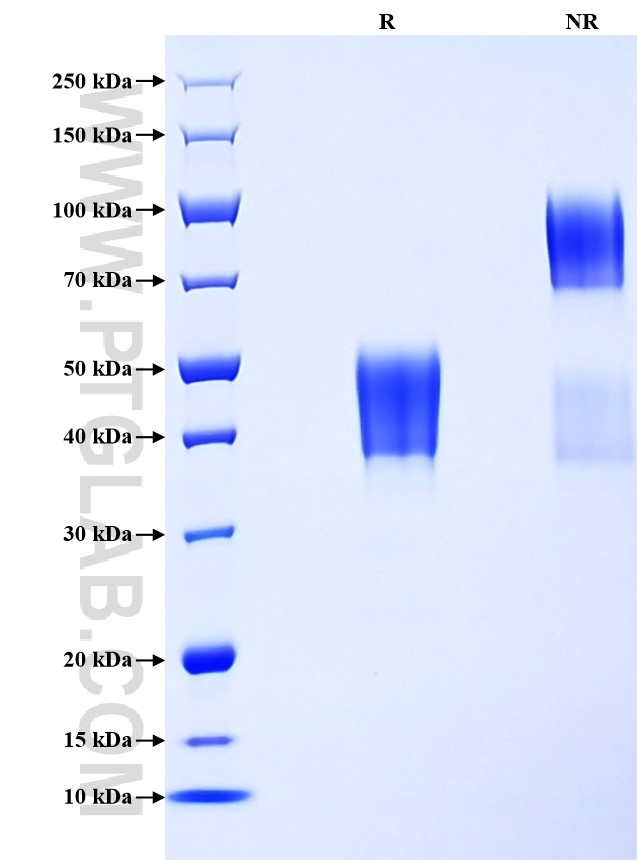Purity of Recombinant Human CD24 was determined by SDS-PAGE. The protein was resolved in an SDS-PAGE in reducing (R) and non-reducing (NR) conditions and stained using Coomassie blue. Purity of Recombinant Human CD24 was determined by SDS-PAGE. The protein was resolved in an SDS-PAGE in reducing (R) and non-reducing (NR) conditions and stained using Coomassie blue.