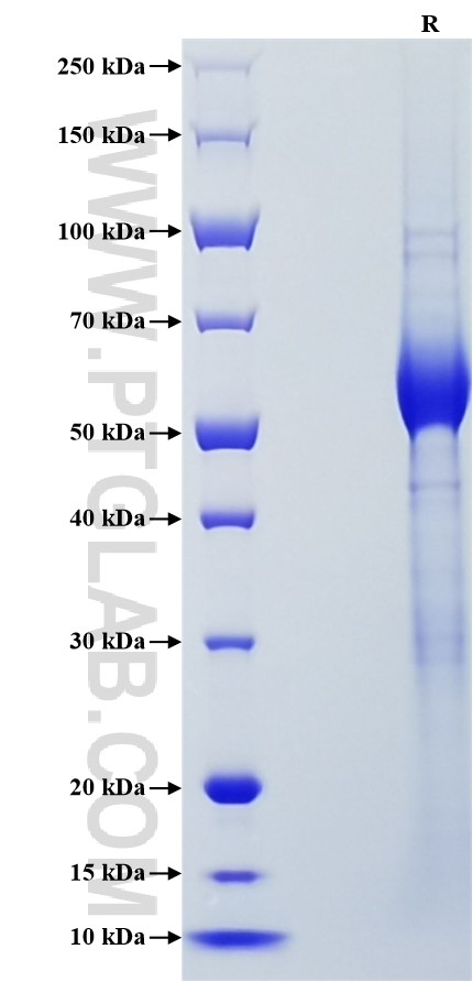 Purity of Recombinant Human CD161 was determined by SDS-PAGE. The protein was resolved in an SDS-PAGE in reducing (R) conditions and stained using Coomassie blue.