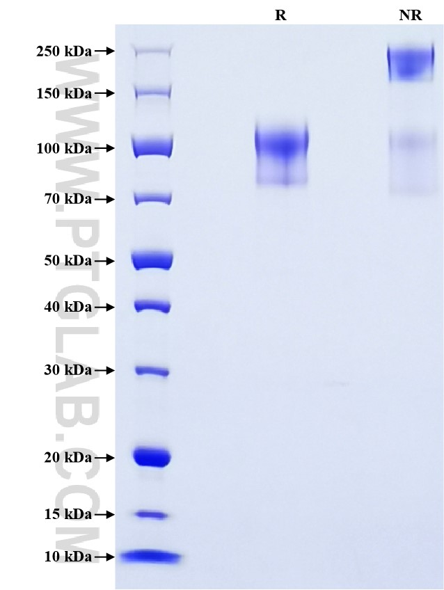 Purity of Recombinant Human CD34 was determined by SDS-PAGE. The protein was resolved in an SDS-PAGE in reducing (R) and non-reducing (NR) conditions and stained using Coomassie blue.