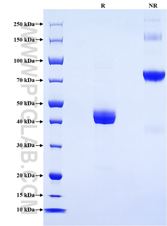 Purity of Recombinant Mouse TNFRSF13B was determined by SDS-PAGE. The protein was resolved in an SDS-PAGE in reducing (R) and non-reducing (NR) conditions and stained using Coomassie blue.