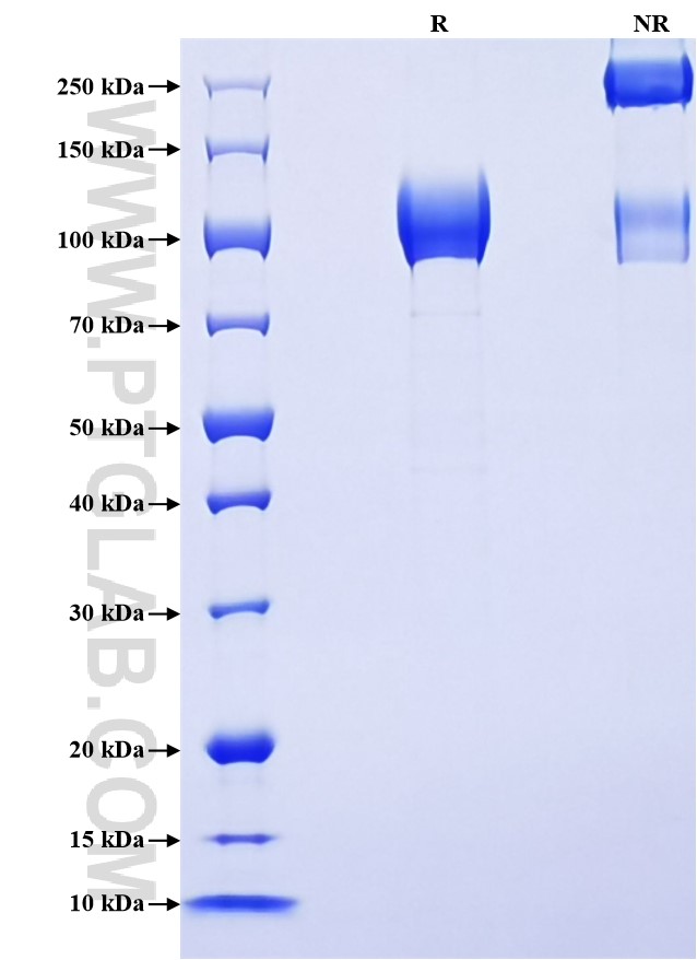 Purity of Recombinant Mouse CSF1R was determined by SDS-PAGE. The protein was resolved in an SDS-PAGE in reducing (R) and non-reducing (NR) conditions and stained using Coomassie blue.