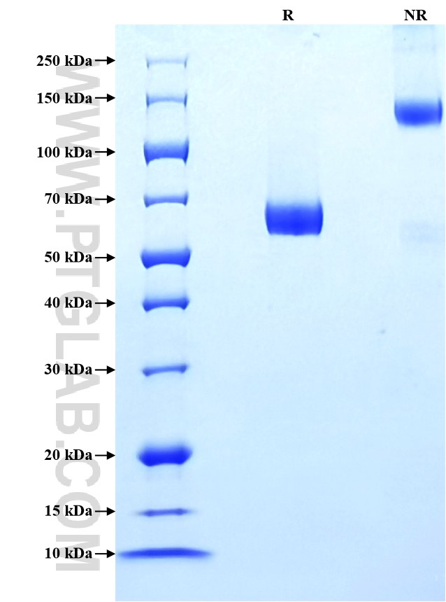 Purity of Recombinant Mouse IL-7Ra was determined by SDS-PAGE. The protein was resolved in an SDS-PAGE in reducing (R) and non-reducing (NR) conditions and stained using Coomassie blue.
