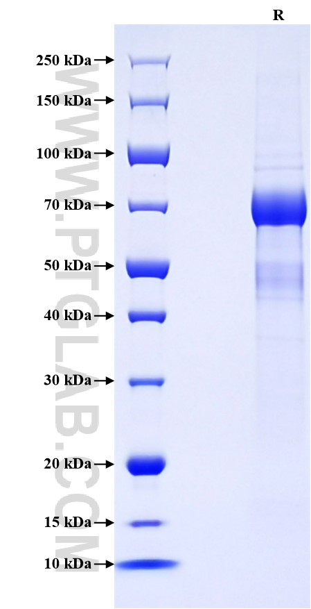 Purity of Recombinant Human IGFBP3 was determined by SDS-PAGE. The protein was resolved in an SDS-PAGE in reducing (R) conditions and stained using Coomassie blue.