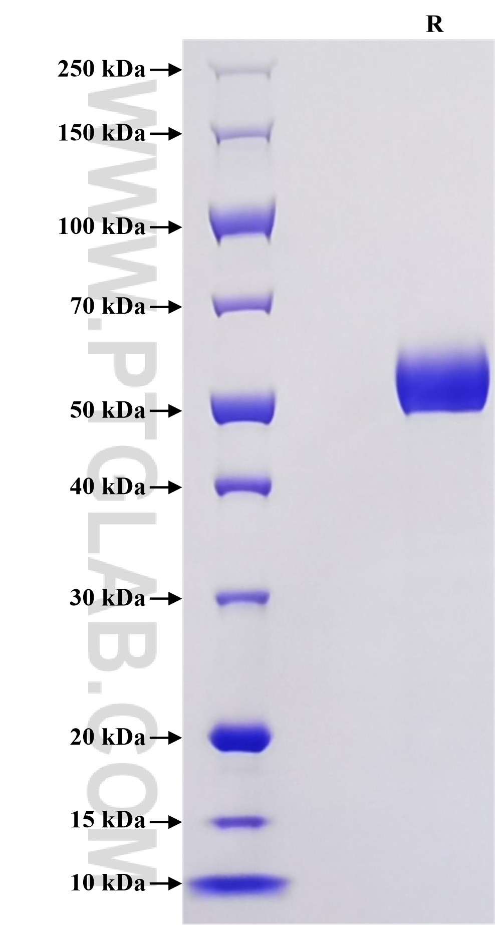 Purity of Recombinant Mouse RANK was determined by SDS-PAGE. The protein was resolved in an SDS-PAGE in reducing (R) conditions and stained using Coomassie blue. Purity of Recombinant Mouse RANK was determined by SDS-PAGE. The protein was resolved in an SDS-PAGE in reducing (R) conditions and stained using Coomassie blue.