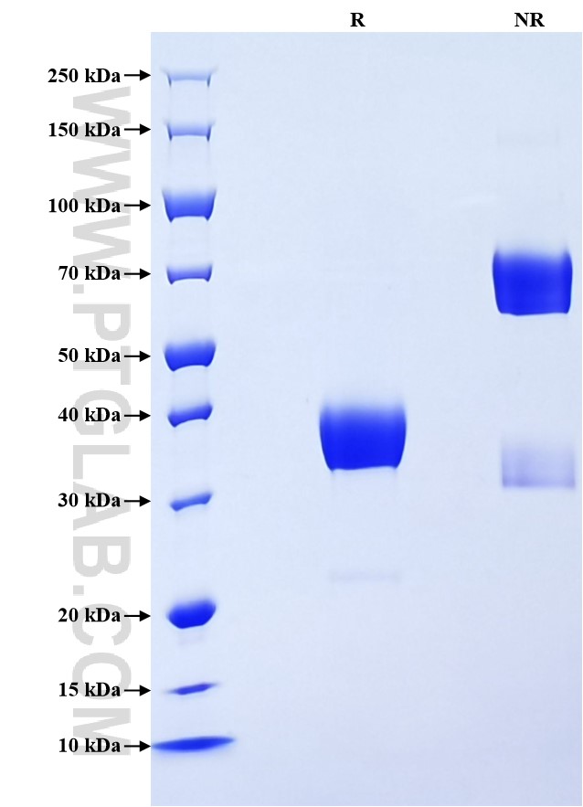 Purity of Recombinant Mouse TWEAKR was determined by SDS-PAGE. The protein was resolved in an SDS-PAGE in reducing (R) and non-reducing (NR) conditions and stained using Coomassie blue.