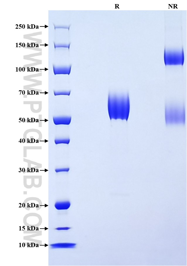 Purity of Recombinant Mouse BTLA was determined by SDS-PAGE. The protein was resolved in an SDS-PAGE in reducing (R) and non-reducing (NR) conditions and stained using Coomassie blue.