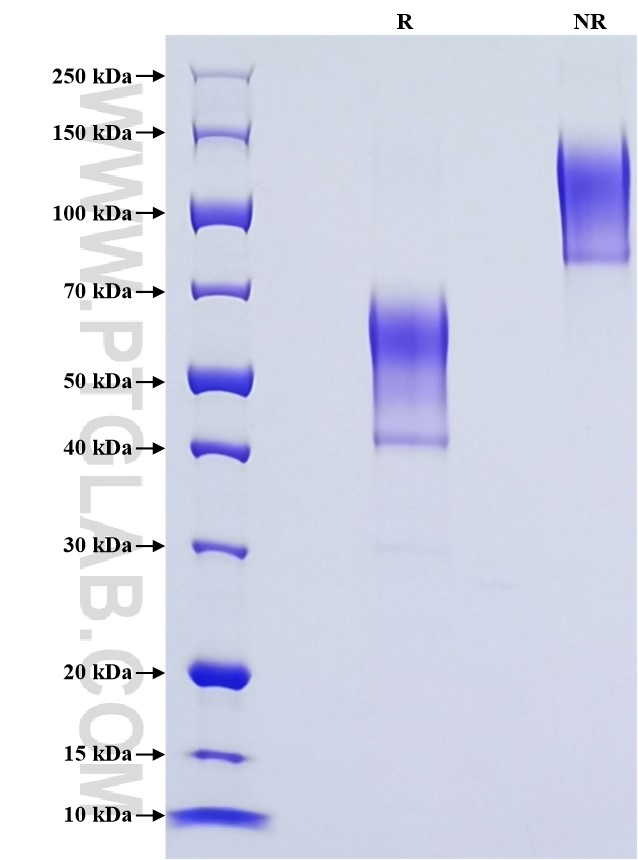 Purity of Recombinant Mouse Glycophorin A was determined by SDS-PAGE. The protein was resolved in an SDS-PAGE in reducing (R) and non-reducing (NR) conditions and stained using Coomassie blue. Purity of Recombinant Mouse Glycophorin A was determined by SDS-PAGE. The protein was resolved in an SDS-PAGE in reducing (R) and non-reducing (NR) conditions and stained using Coomassie blue.