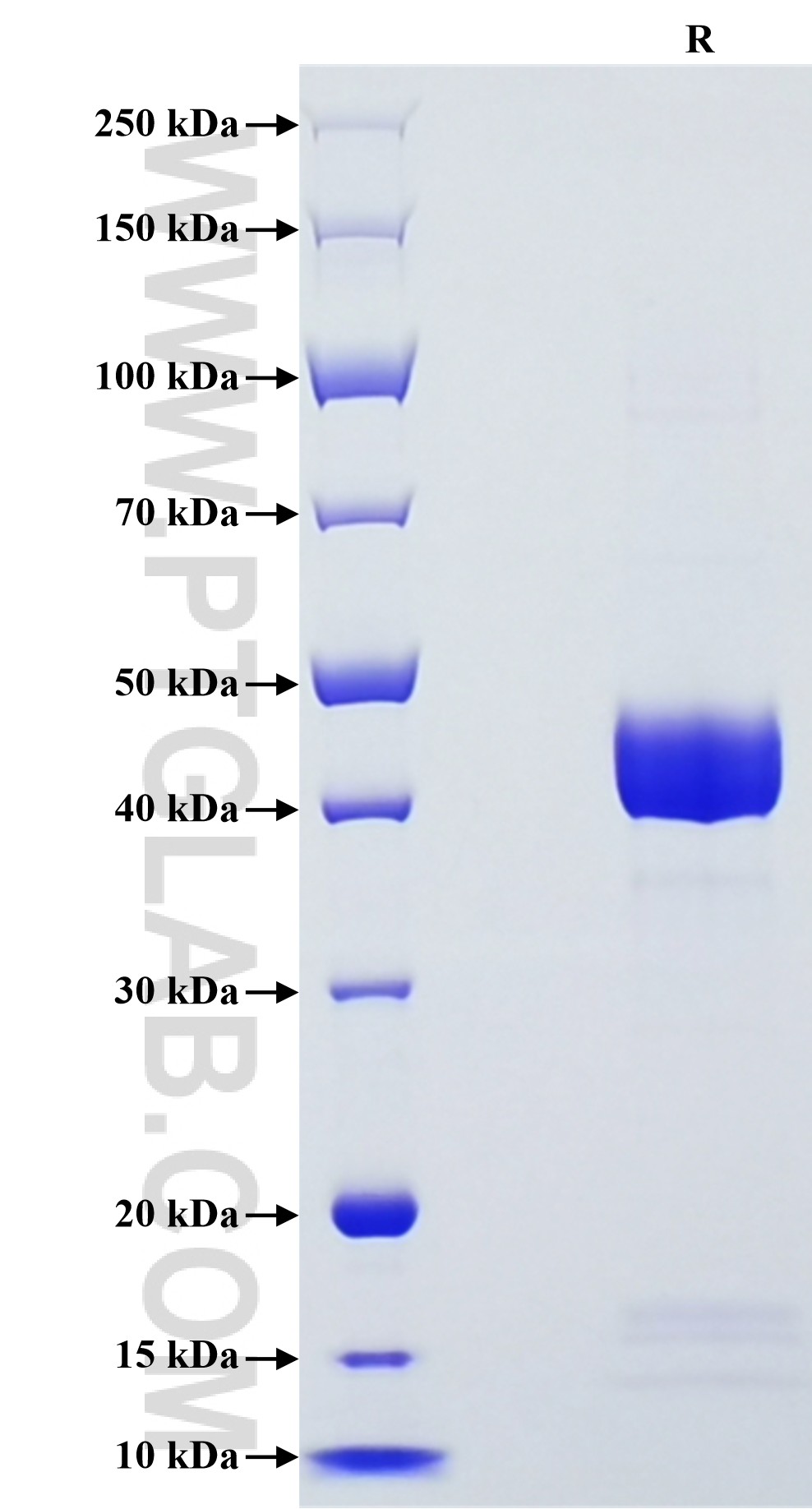 Purity of Recombinant Human Angiogenin was determined by SDS-PAGE. The protein was resolved in an SDS-PAGE in reducing (R) conditions and stained using Coomassie blue. Purity of Recombinant Human Angiogenin was determined by SDS-PAGE. The protein was resolved in an SDS-PAGE in reducing (R) conditions and stained using Coomassie blue.