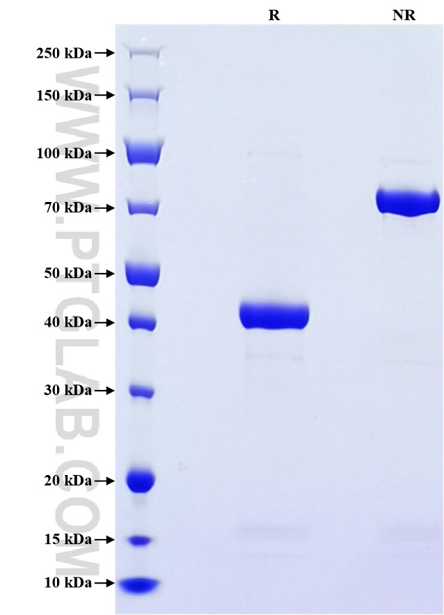 Purity of Recombinant Human Angiogenin was determined by SDS-PAGE. The protein was resolved in an SDS-PAGE in reducing (R) and non-reducing (NR) conditions and stained using Coomassie blue.