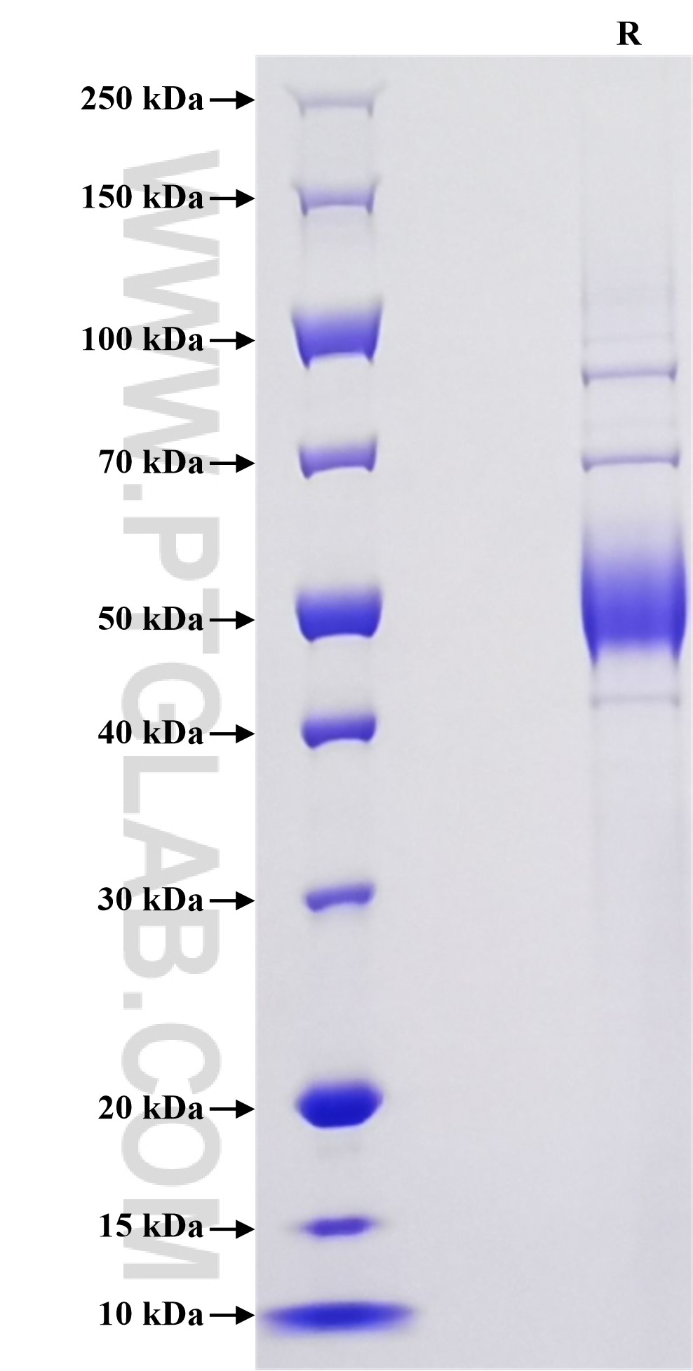 Purity of Recombinant Human NKG2C was determined by SDS-PAGE. The protein was resolved in an SDS-PAGE in reducing (R) conditions and stained using Coomassie blue.