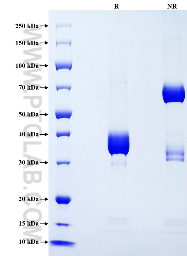 Purity of Recombinant Human CCL22 was determined by SDS-PAGE. The protein was resolved in an SDS-PAGE in reducing (R) and non-reducing (NR) conditions and stained using Coomassie blue.