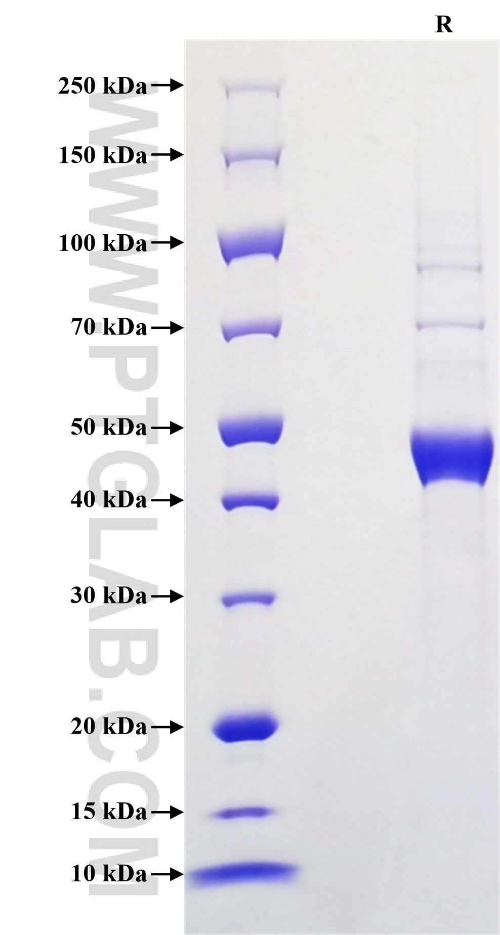 Purity of Recombinant Human IL-15 was determined by SDS-PAGE. The protein was resolved in an SDS-PAGE in reducing (R) conditions and stained using Coomassie blue.