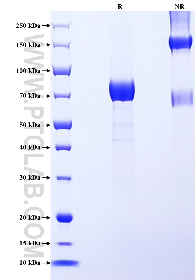 Purity of Recombinant Human IL-3RA was determined by SDS-PAGE. The protein was resolved in an SDS-PAGE in reducing (R) and non-reducing (NR) conditions and stained using Coomassie blue.