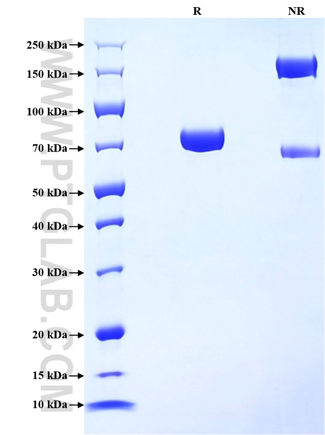Purity of Recombinant Rat CD4 was determined by SDS-PAGE. The protein was resolved in an SDS-PAGE in reducing (R) and non-reducing (NR) conditions and stained using Coomassie blue.