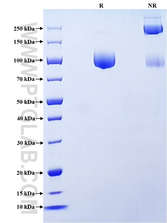 Purity of Recombinant Mouse CD107b was determined by SDS-PAGE. The protein was resolved in an SDS-PAGE in reducing (R) and non-reducing (NR) conditions and stained using Coomassie blue.