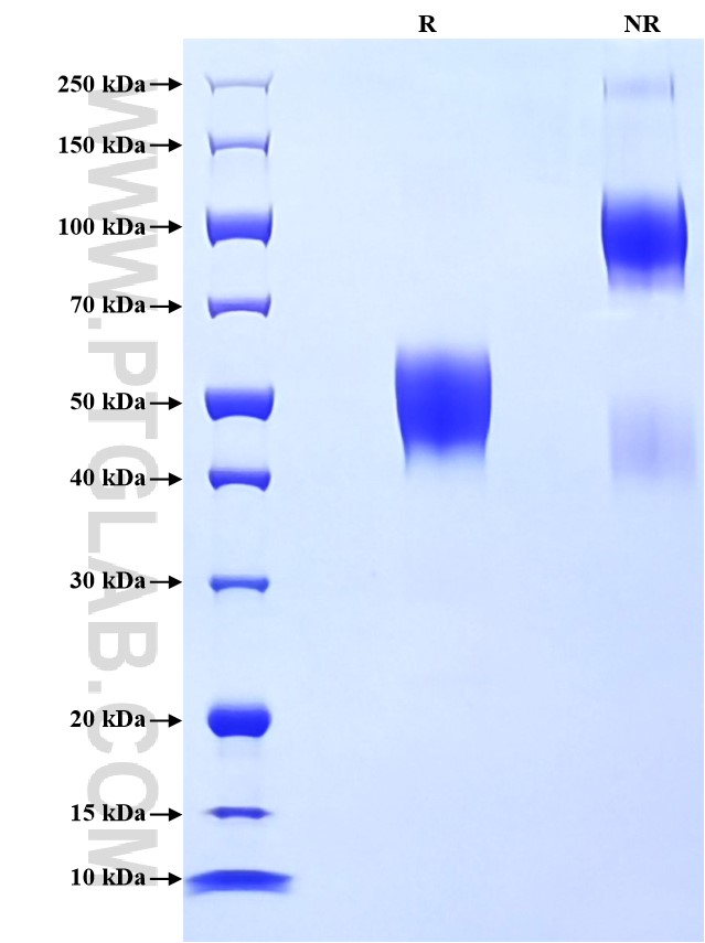 Purity of Recombinant Human CD83 was determined by SDS-PAGE. The protein was resolved in an SDS-PAGE in reducing (R) and non-reducing (NR) conditions and stained using Coomassie blue.