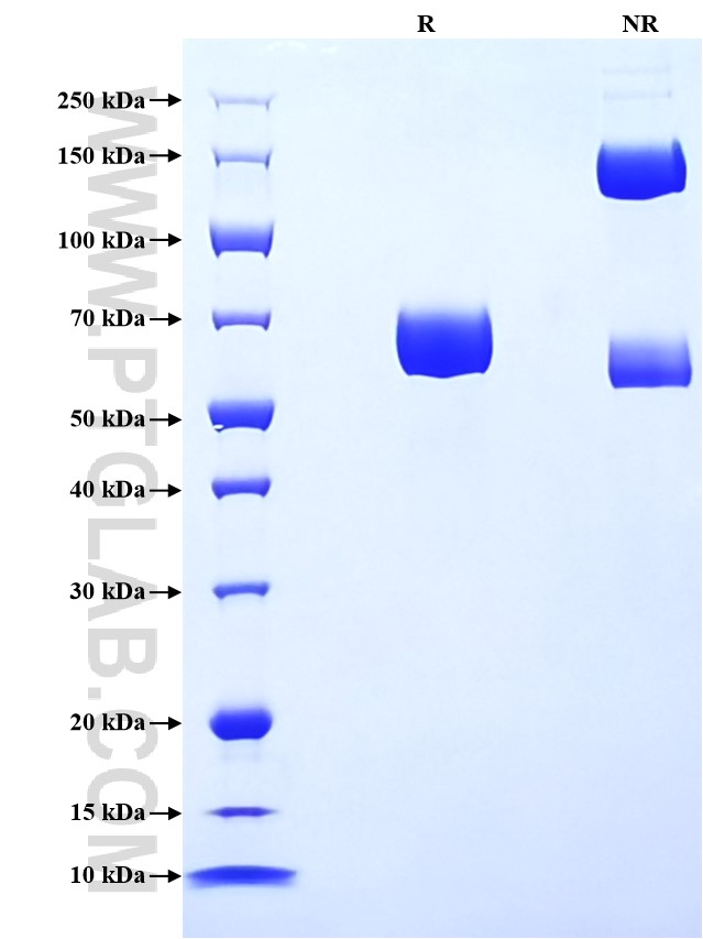 Purity of Recombinant Human CD157 was determined by SDS-PAGE. The protein was resolved in an SDS-PAGE in reducing (R) and non-reducing (NR) conditions and stained using Coomassie blue. Purity of Recombinant Human CD157 was determined by SDS-PAGE. The protein was resolved in an SDS-PAGE in reducing (R) and non-reducing (NR) conditions and stained using Coomassie blue.