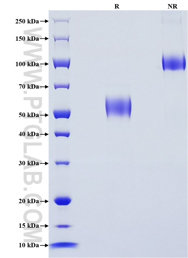 Purity of Recombinant Human CD79B was determined by SDS-PAGE. The protein was resolved in an SDS-PAGE in reducing (R) and non-reducing (NR) conditions and stained using Coomassie blue.