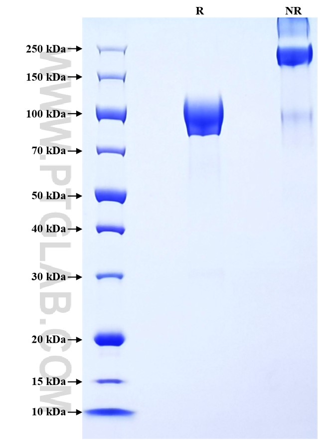 Purity of Recombinant Human CD6 was determined by SDS-PAGE. The protein was resolved in an SDS-PAGE in reducing (R) and non-reducing (NR) conditions and stained using Coomassie blue.