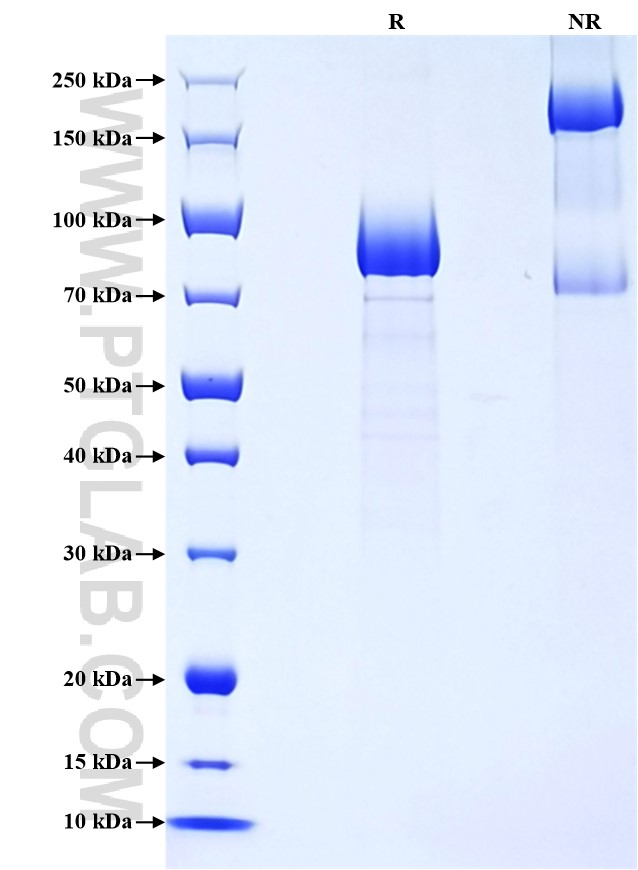 Purity of Recombinant Human CD97 was determined by SDS-PAGE. The protein was resolved in an SDS-PAGE in reducing (R) and non-reducing (NR) conditions and stained using Coomassie blue. Purity of Recombinant Human CD97 was determined by SDS-PAGE. The protein was resolved in an SDS-PAGE in reducing (R) and non-reducing (NR) conditions and stained using Coomassie blue.