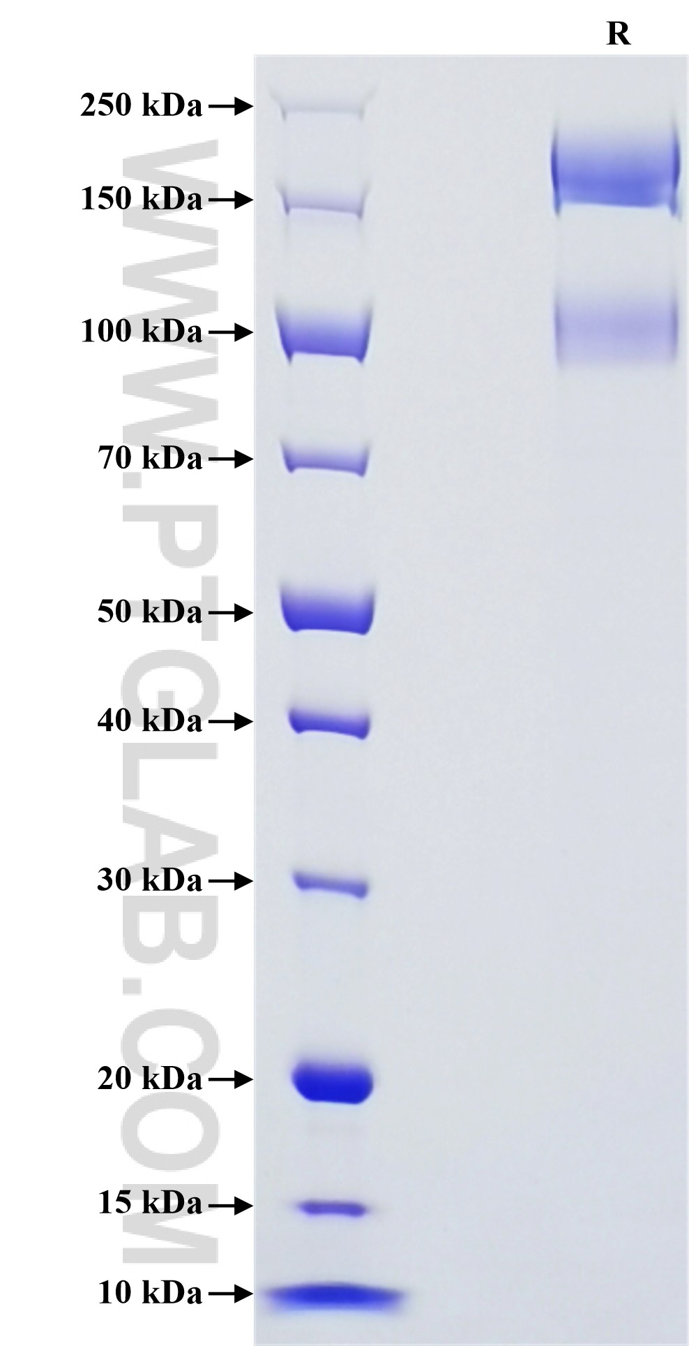 Purity of Recombinant Human Integrin alpha-1 beta-1 was determined by SDS-PAGE. The protein was resolved in an SDS-PAGE in reducing (R) conditions and stained using Coomassie blue. Purity of Recombinant Human Integrin alpha-1 beta-1 was determined by SDS-PAGE. The protein was resolved in an SDS-PAGE in reducing (R) conditions and stained using Coomassie blue.
