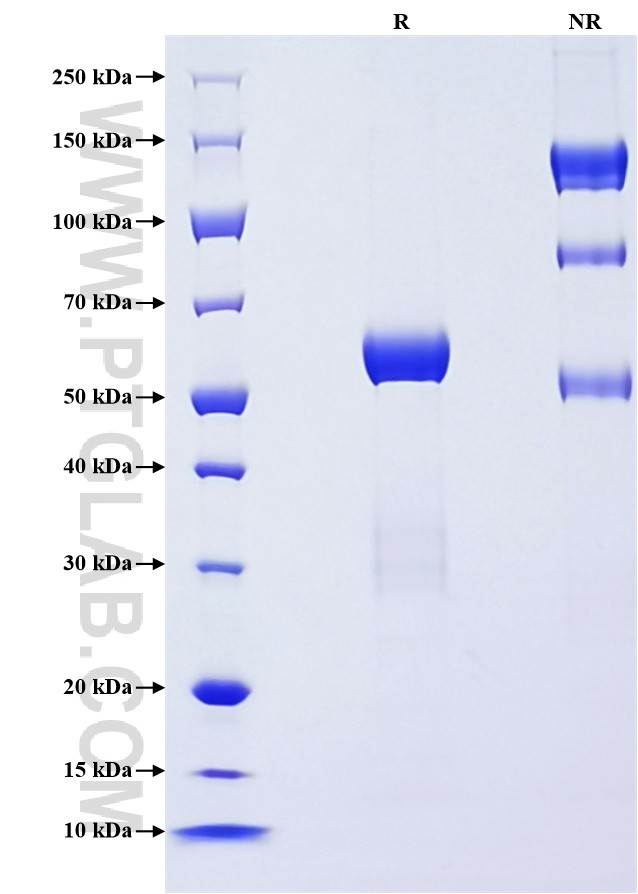 Purity of Recombinant Mouse Neutrophil elastase was determined by SDS-PAGE. The protein was resolved in an SDS-PAGE in reducing (R) and non-reducing (NR) conditions and stained using Coomassie blue.