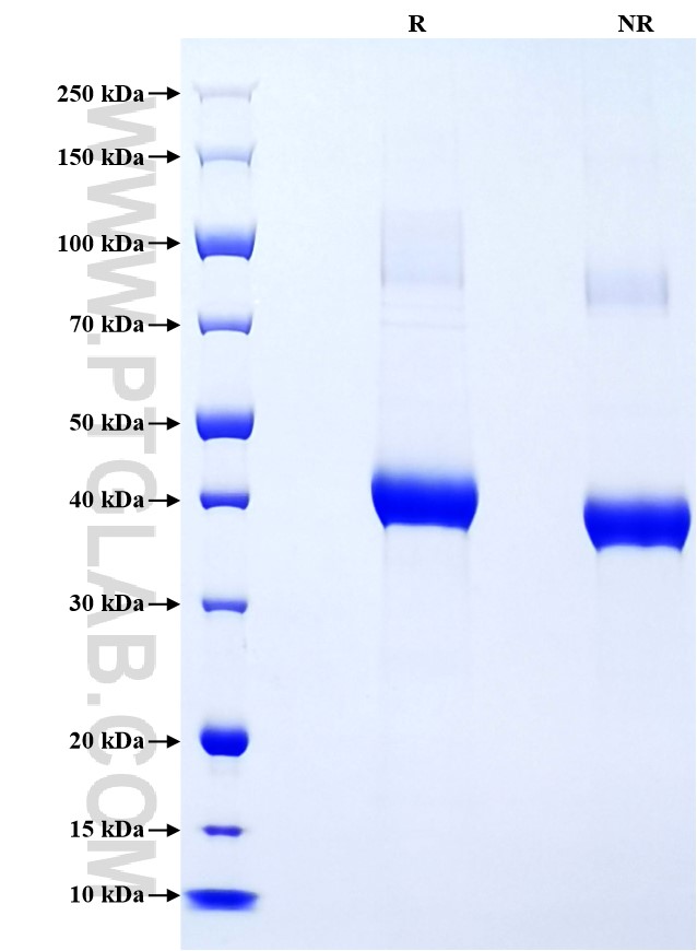 Purity of Recombinant Human ACVRL1 was determined by SDS-PAGE. The protein was resolved in an SDS-PAGE in reducing (R) and non-reducing (NR) conditions and stained using Coomassie blue.