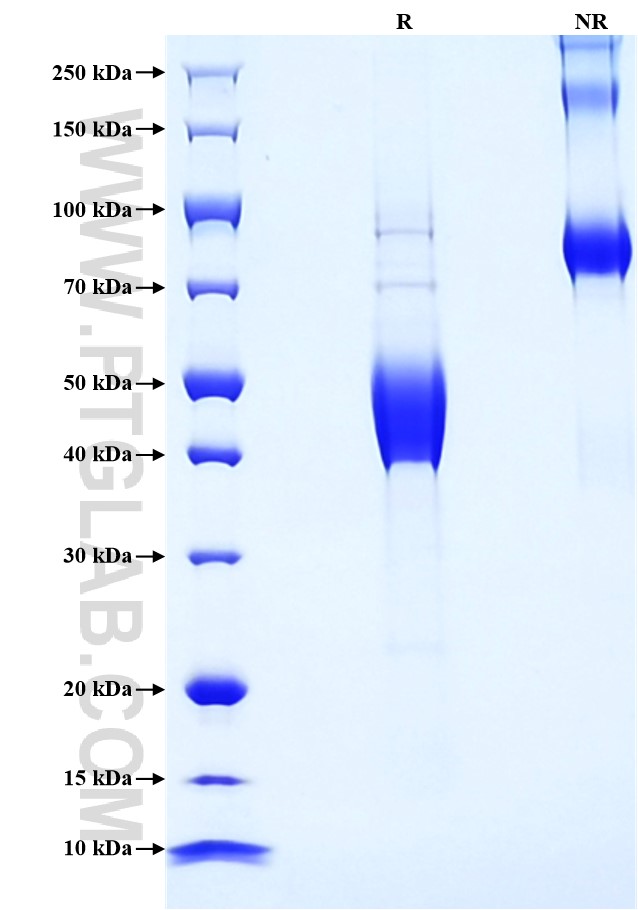 Purity of Recombinant Human CD3 gamma was determined by SDS-PAGE. The protein was resolved in an SDS-PAGE in reducing (R) and non-reducing (NR) conditions and stained using Coomassie blue.