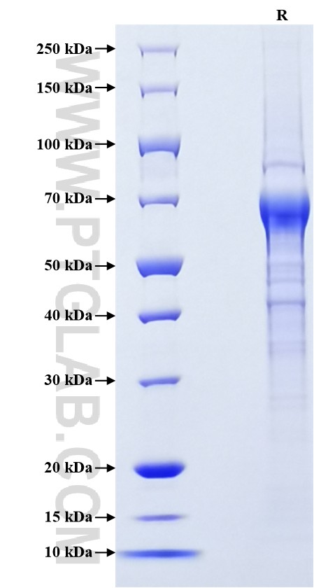 Purity of Recombinant Human CXCL16 was determined by SDS-PAGE. The protein was resolved in an SDS-PAGE in reducing (R) conditions and stained using Coomassie blue. Purity of Recombinant Human CXCL16 was determined by SDS-PAGE. The protein was resolved in an SDS-PAGE in reducing (R) conditions and stained using Coomassie blue.