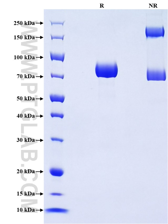 Purity of Recombinant Mouse IL-3RB was determined by SDS-PAGE. The protein was resolved in an SDS-PAGE in reducing (R) and non-reducing (NR) conditions and stained using Coomassie blue.