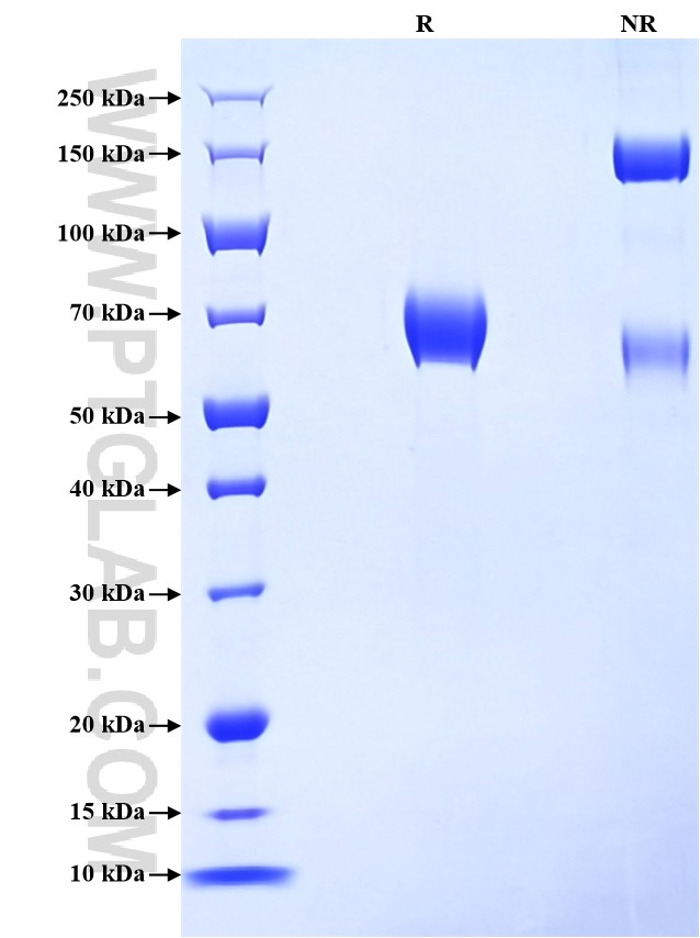 Purity of Recombinant Mouse IL-4RA was determined by SDS-PAGE. The protein was resolved in an SDS-PAGE in reducing (R) and non-reducing (NR) conditions and stained using Coomassie blue.