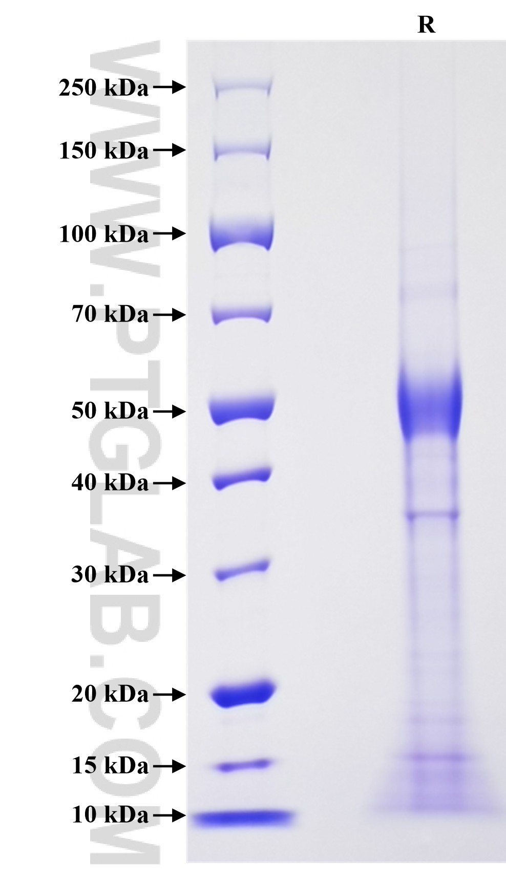 Purity of Recombinant Mouse IL-15 was determined by SDS-PAGE. The protein was resolved in an SDS-PAGE in reducing (R) conditions and stained using Coomassie blue.