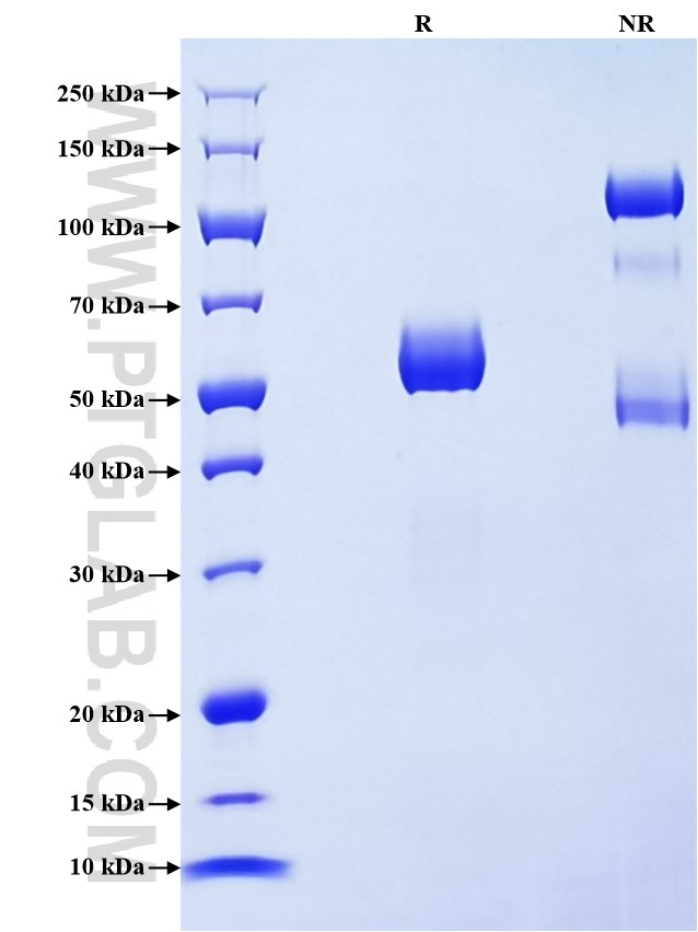Purity of Recombinant Human CTRL was determined by SDS-PAGE. The protein was resolved in an SDS-PAGE in reducing (R) and non-reducing (NR) conditions and stained using Coomassie blue.