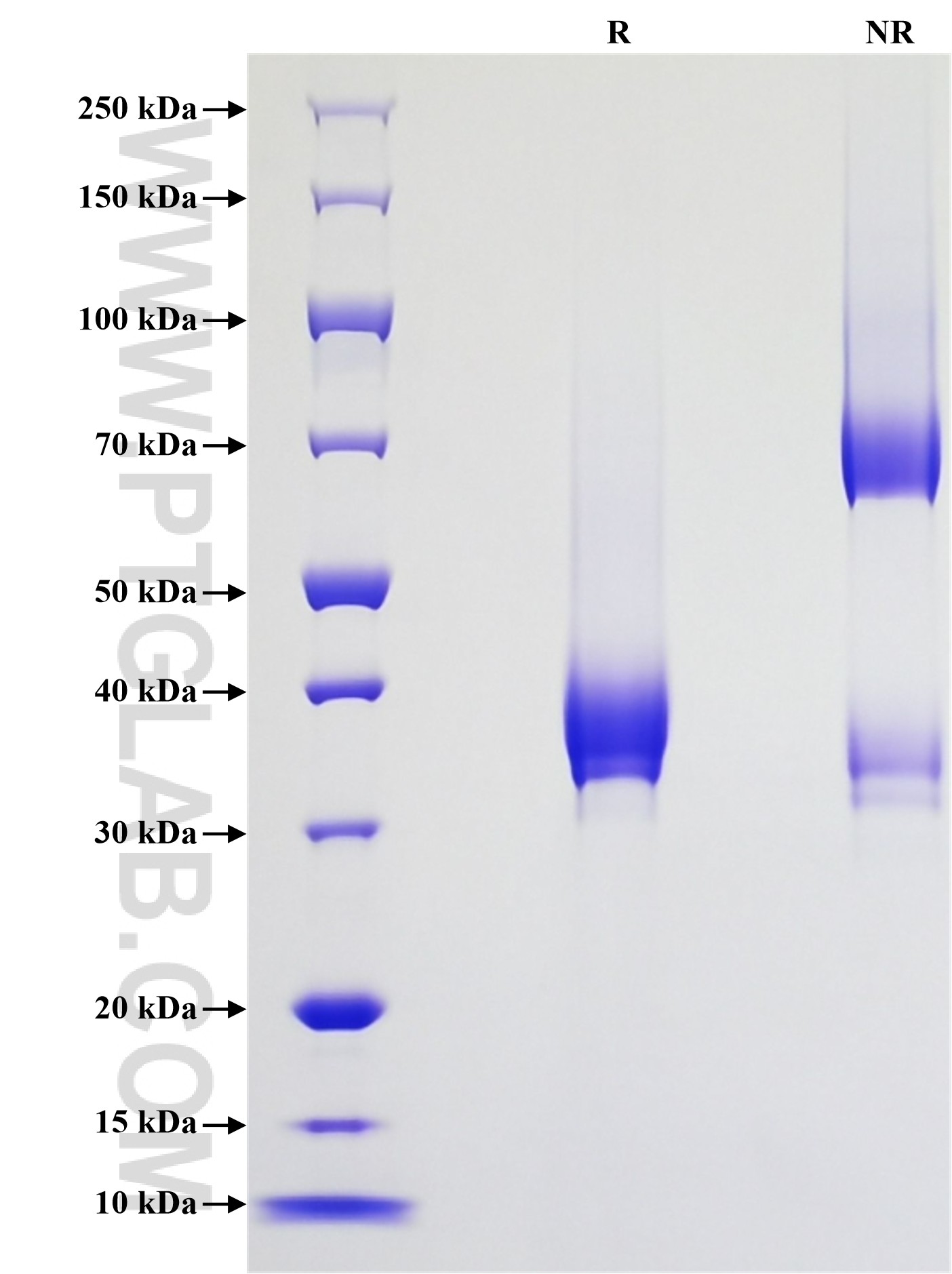 Purity of Recombinant Mouse CXCR2 was determined by SDS-PAGE. The protein was resolved in an SDS-PAGE in reducing (R) and non-reducing (NR) conditions and stained using Coomassie blue.