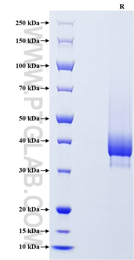Purity of Recombinant Mouse CXCR4 was determined by SDS-PAGE. The protein was resolved in an SDS-PAGE in reducing (R) conditions and stained using Coomassie blue. Purity of Recombinant Mouse CXCR4 was determined by SDS-PAGE. The protein was resolved in an SDS-PAGE in reducing (R) conditions and stained using Coomassie blue.