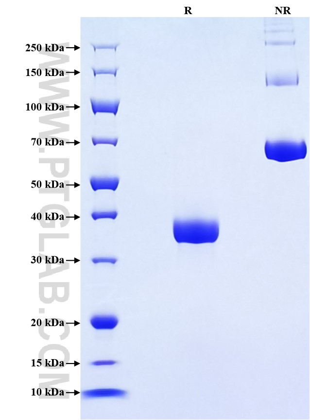 Purity of Recombinant Human OXT was determined by SDS-PAGE. The protein was resolved in an SDS-PAGE in reducing (R) and non-reducing (NR) conditions and stained using Coomassie blue. Purity of Recombinant Human OXT was determined by SDS-PAGE. The protein was resolved in an SDS-PAGE in reducing (R) and non-reducing (NR) conditions and stained using Coomassie blue.