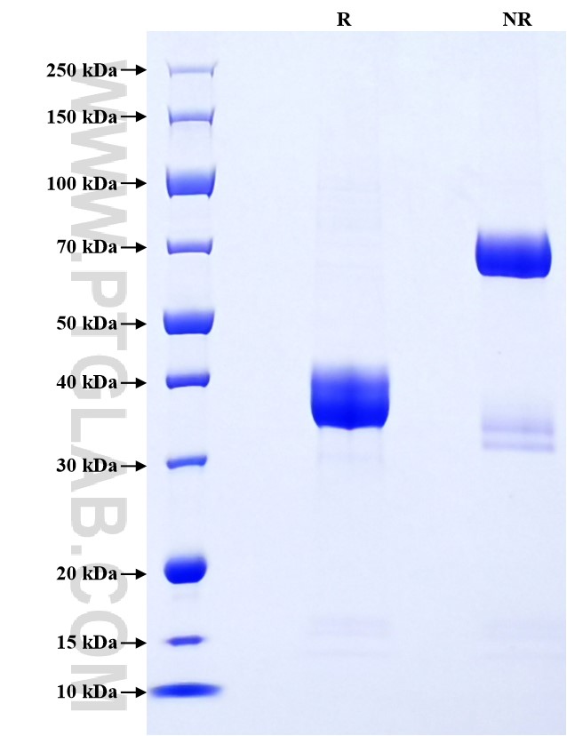 Purity of Recombinant Mouse CCL22 was determined by SDS-PAGE. The protein was resolved in an SDS-PAGE in reducing (R) and non-reducing (NR) conditions and stained using Coomassie blue.