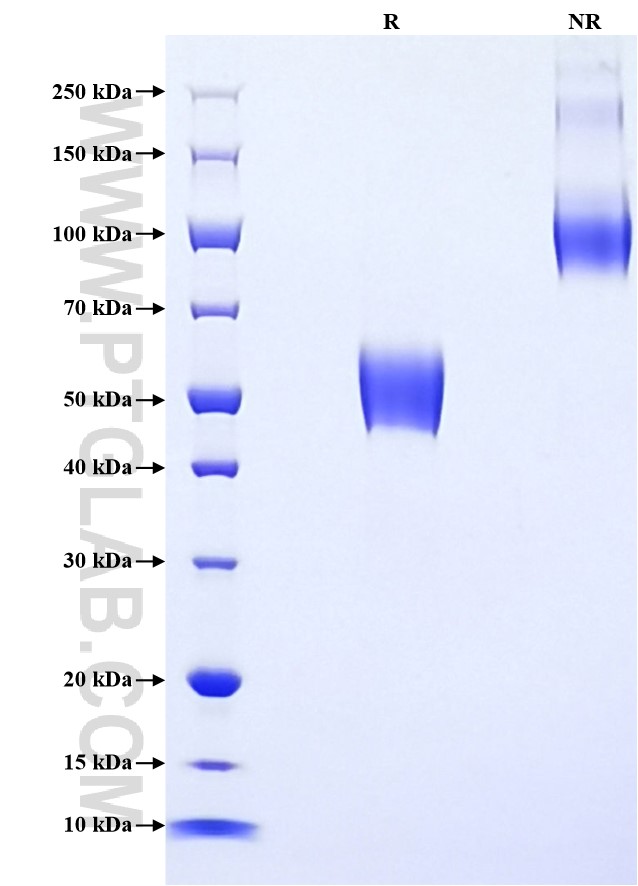 Purity of Recombinant Human TMIGD2 was determined by SDS-PAGE. The protein was resolved in an SDS-PAGE in reducing (R) and non-reducing (NR) conditions and stained using Coomassie blue.