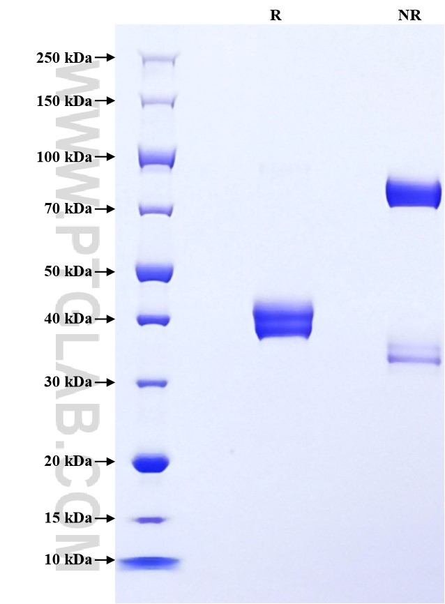 Purity of Recombinant Human Beta-2-Microglobulin was determined by SDS-PAGE. The protein was resolved in an SDS-PAGE in reducing (R) and non-reducing (NR) conditions and stained using Coomassie blue. Purity of Recombinant Human Beta-2-Microglobulin was determined by SDS-PAGE. The protein was resolved in an SDS-PAGE in reducing (R) and non-reducing (NR) conditions and stained using Coomassie blue.