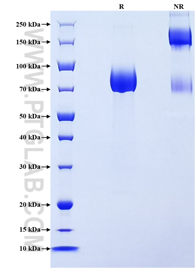 Purity of Recombinant Human IL-13Ra1 was determined by SDS-PAGE. The protein was resolved in an SDS-PAGE in reducing (R) and non-reducing (NR) conditions and stained using Coomassie blue.