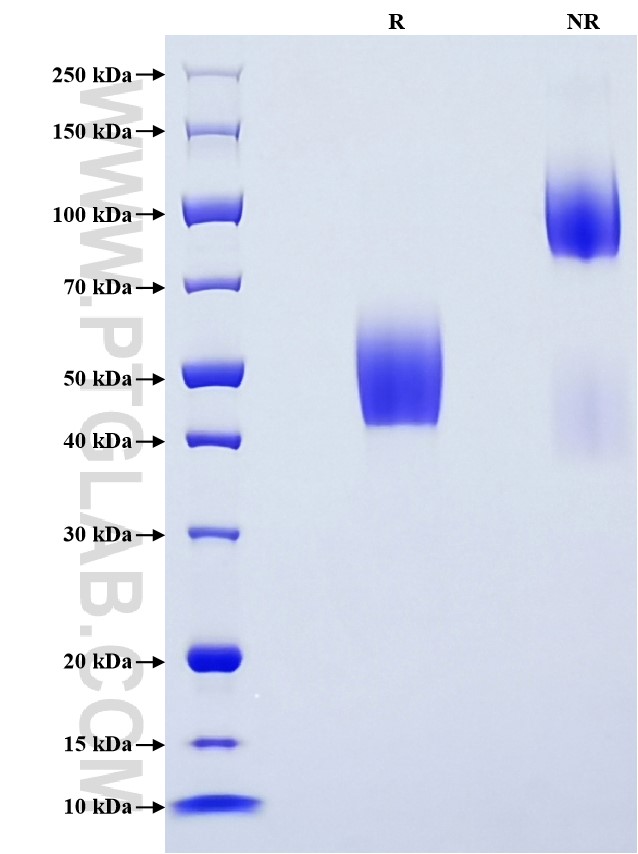 Purity of Recombinant Human TSPAN7 was determined by SDS-PAGE. The protein was resolved in an SDS-PAGE in reducing (R) and non-reducing (NR) conditions and stained using Coomassie blue. Purity of Recombinant Human TSPAN7 was determined by SDS-PAGE. The protein was resolved in an SDS-PAGE in reducing (R) and non-reducing (NR) conditions and stained using Coomassie blue.